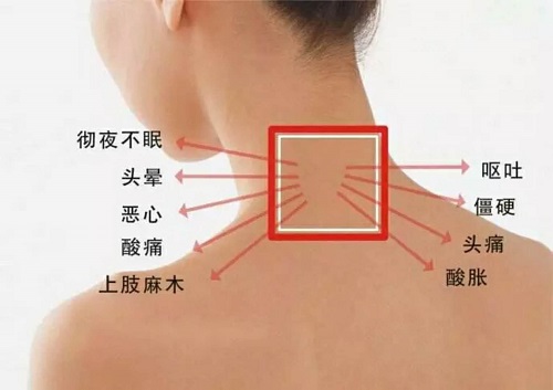 你的頸椎還健康嗎？